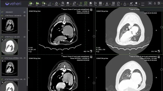 Veheri DICOM viewer showing transverse CT images
